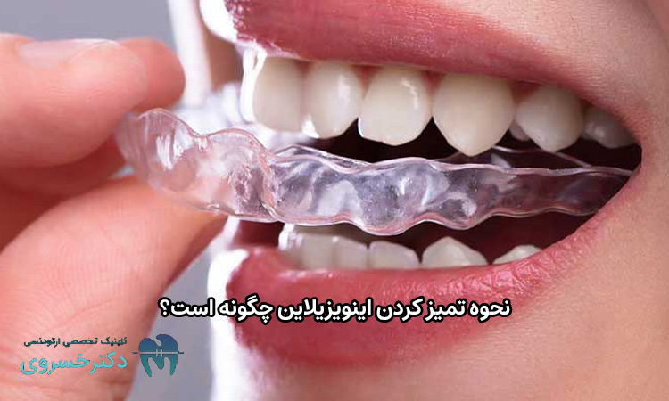 نحوه تمیز کردن اینویزیلاین