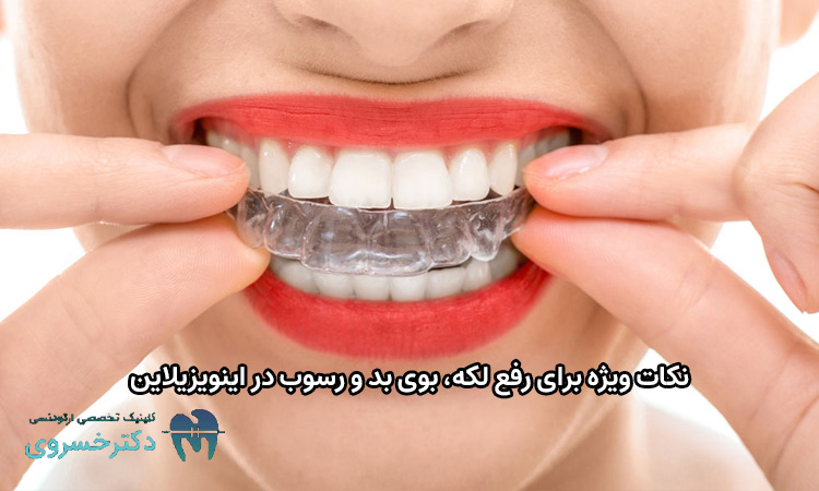 نکات رفع لکه، بوی بد و رسوب در اینویزیلاین