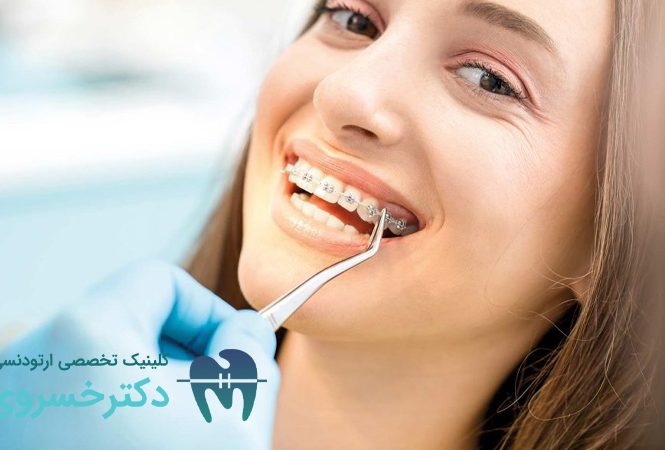لق شدن دندان با ارتودنسی