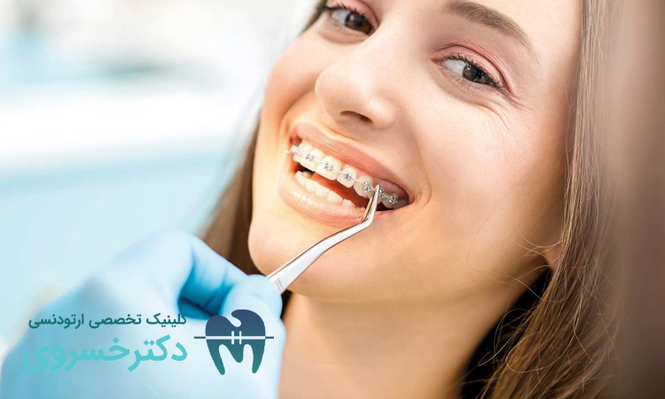 لق شدن دندان با ارتودنسی