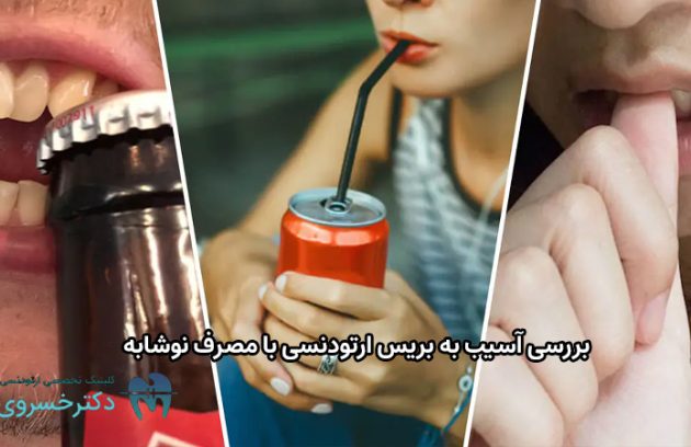آسیب به بریس ارتودنسی با مصرف نوشابه.
