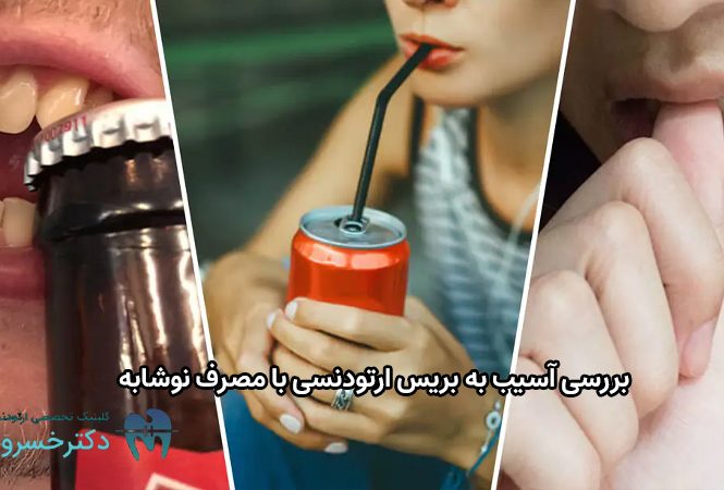 آسیب به بریس ارتودنسی با مصرف نوشابه.