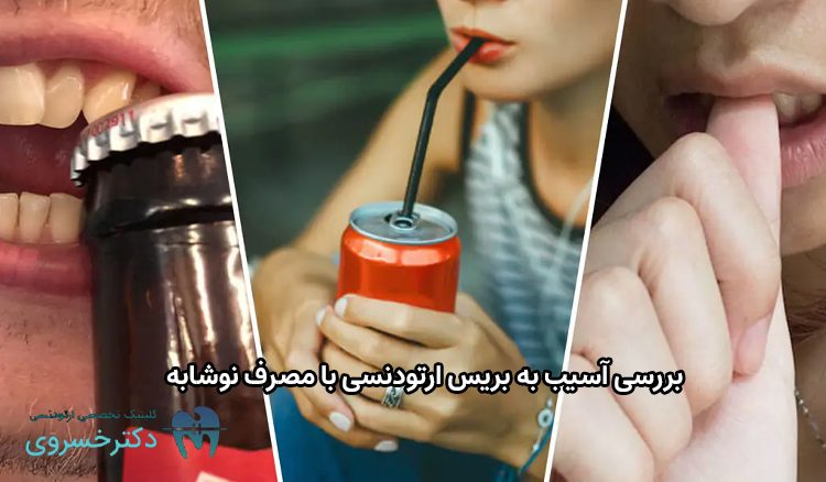 آسیب به بریس ارتودنسی با مصرف نوشابه.