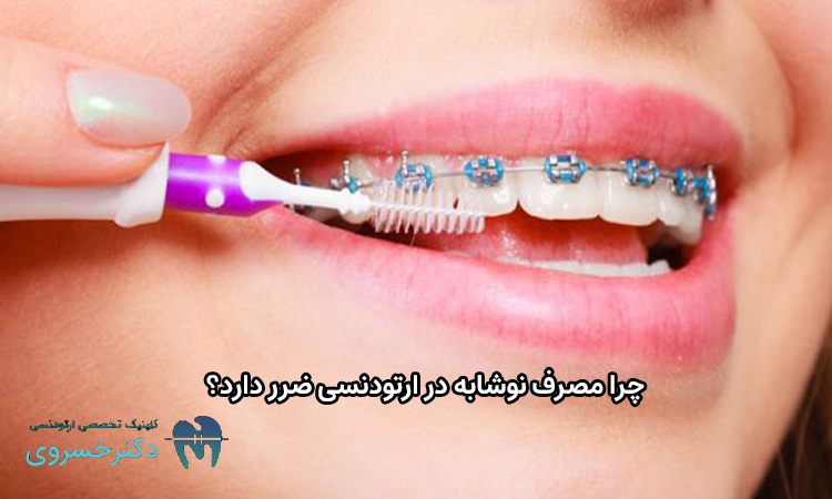 ضرر مصرف نوشابه در ارتودنسی