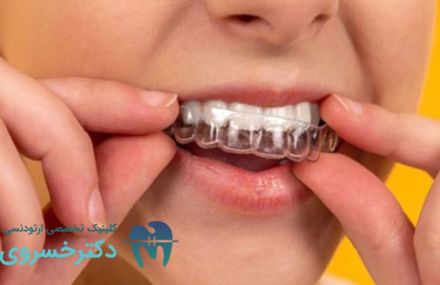 مناسب بودن ارتودنسی نامرئی برای کودکان