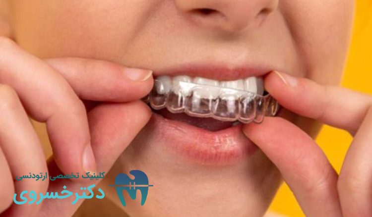 مناسب بودن ارتودنسی نامرئی برای کودکان