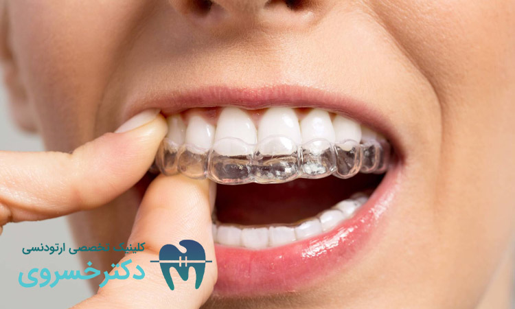 آیا درد ارتودنسی متحرک با استفاده مداوم کاهش مییابد؟