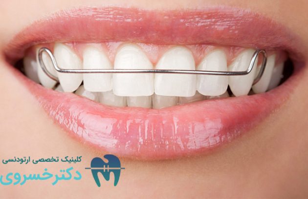 دندان هایی که ارتودنسی متحرک نیاز دارند