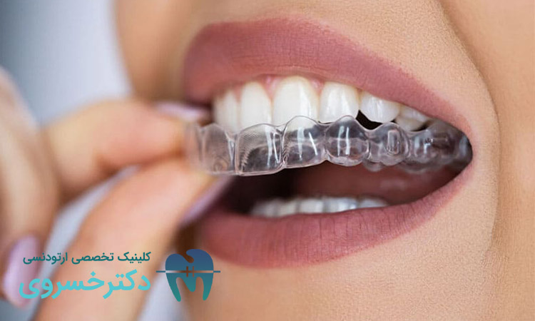 ارتودنسی نامرئی برای چه افرادی مناسب نیست؟