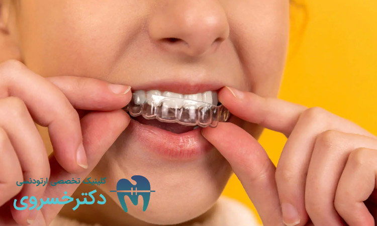 ارتودنسی نامرئی برای چه دندان‌هایی مناسب است؟