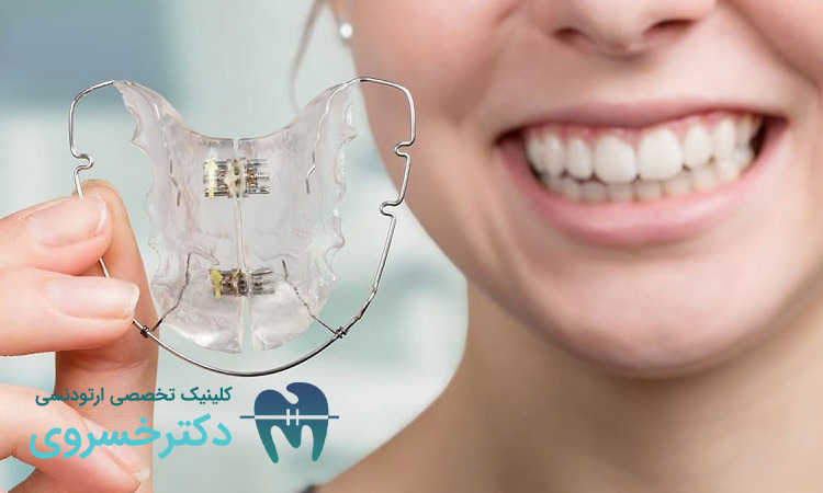 مزایای استفاده از ارتودنسی متحرک در فواصل دندانی