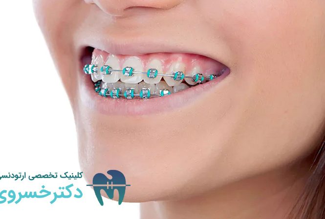 اثرات ارتودنسی بر بهبود کیفیت خواب