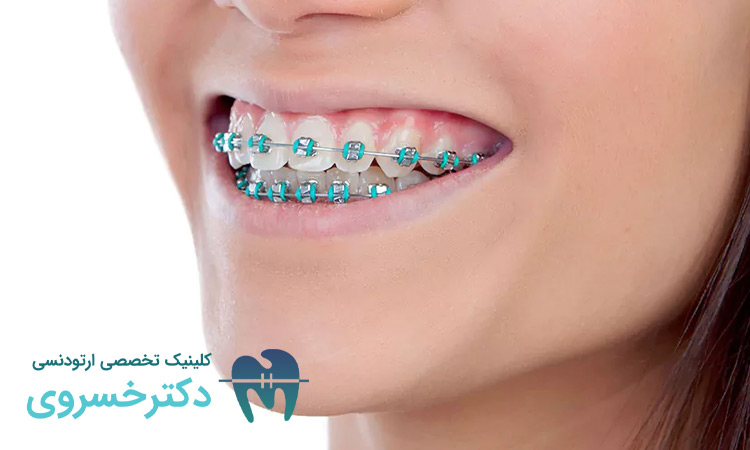 اثرات ارتودنسی بر بهبود کیفیت خواب