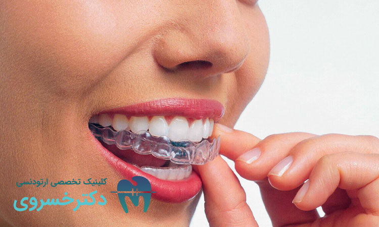 نحوه استفاده از ارتودنسی متحرک و بررسی درد آن