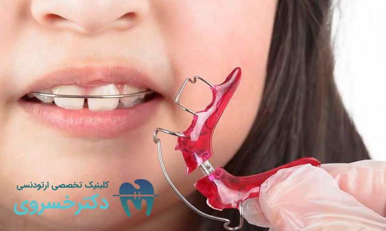 نگهدارنده متحرک چیست