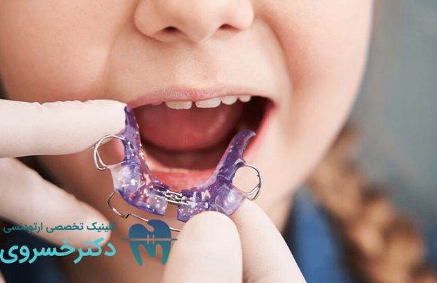 استفاده از ارتودنسی متحرک برای کودکان