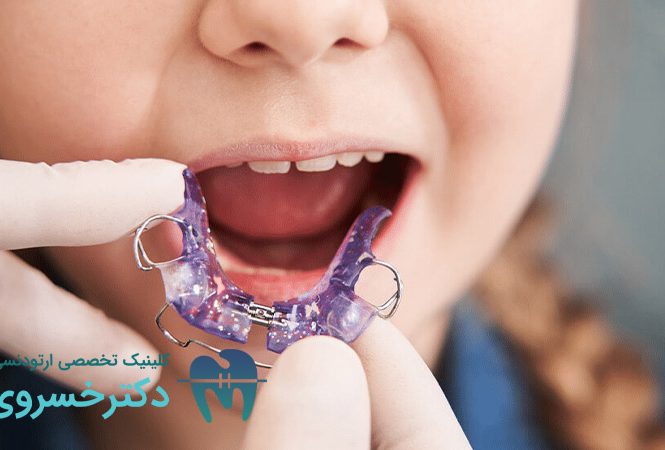 استفاده از ارتودنسی متحرک برای کودکان