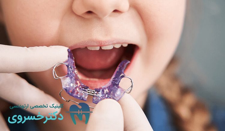 استفاده از ارتودنسی متحرک برای کودکان
