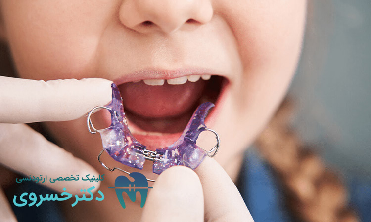 استفاده از ارتودنسی متحرک برای کودکان