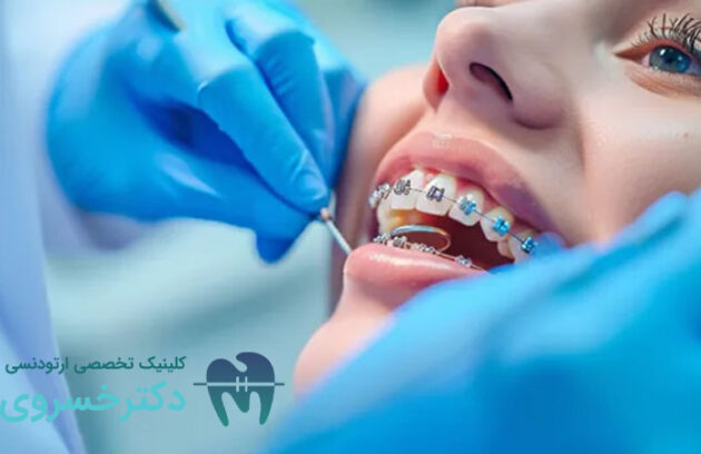 آینده درمان‌های ارتودنسی