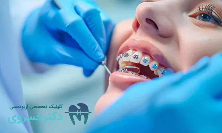 آینده درمان‌های ارتودنسی