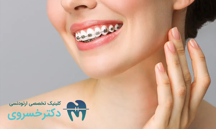 ارتباط درمان ارتودنسی با بهبود تصویر ذهنی از خود