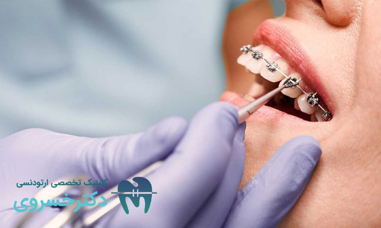 تأثیر درمان بر کاهش اضطراب اجتماعی