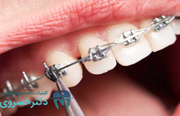 تکنولوژی های نوین ارتودنسی