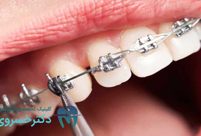 تکنولوژی های نوین ارتودنسی