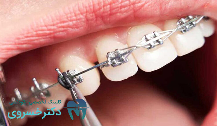 تکنولوژی های نوین ارتودنسی