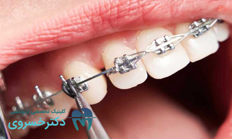 تکنولوژی های نوین ارتودنسی