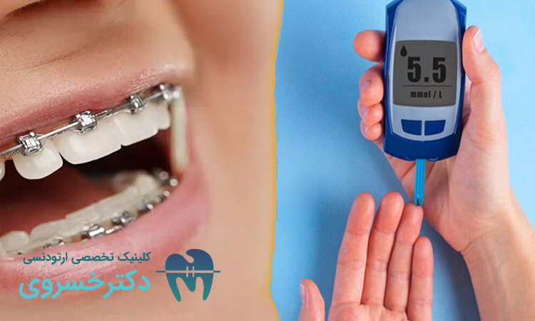 دیابت و تأثیر آن بر درمان ارتودنسی