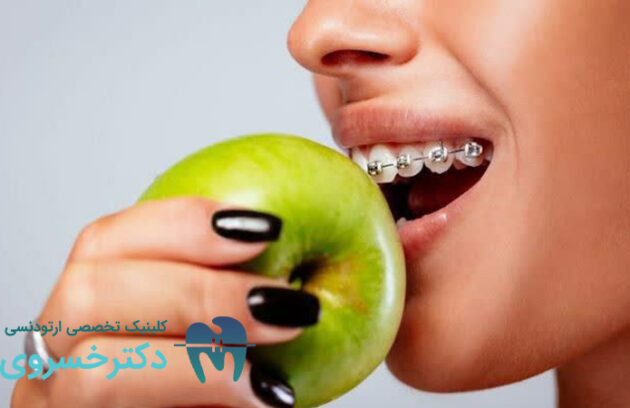 راهنمای تغذیه و تأثیر میکروبیوتا دهان بر روند درمان ارتودنسی