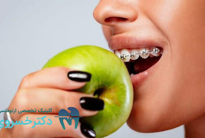 راهنمای تغذیه و تأثیر میکروبیوتا دهان بر روند درمان ارتودنسی