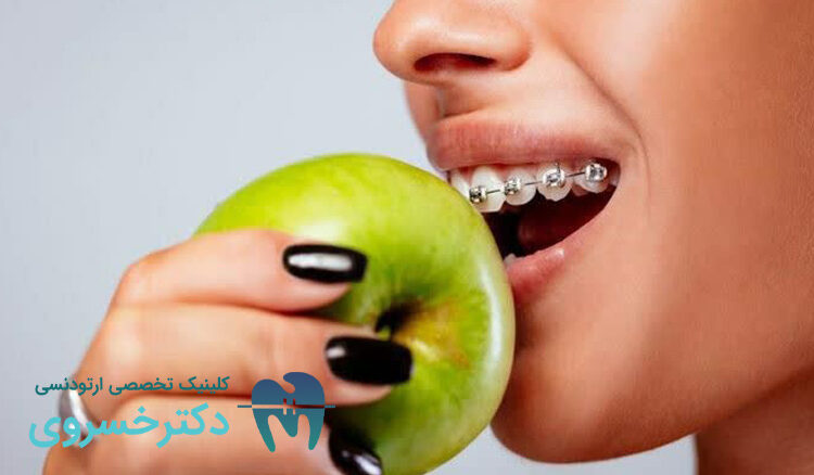 راهنمای تغذیه و تأثیر میکروبیوتا دهان بر روند درمان ارتودنسی