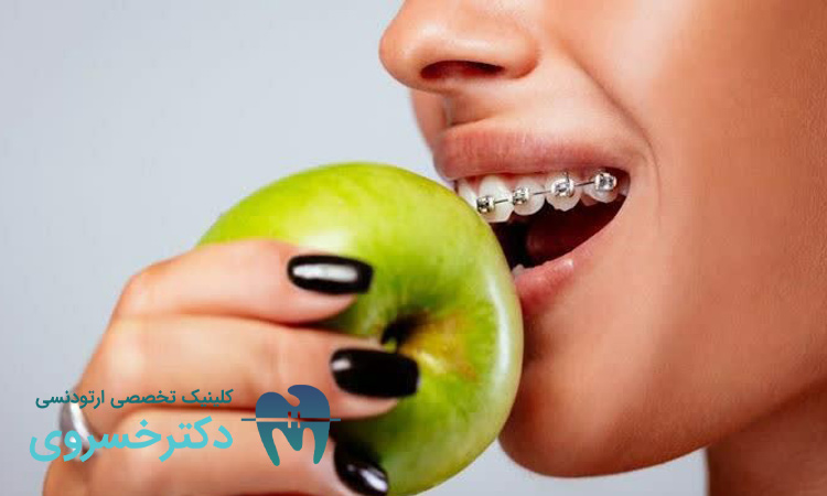راهنمای تغذیه و تأثیر میکروبیوتا دهان بر روند درمان ارتودنسی