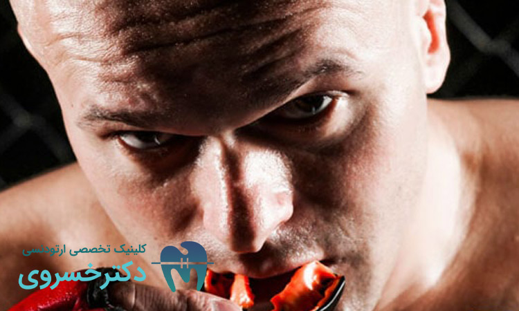 روش های پیشگیری و درمان دندان در ورزش های رزمی