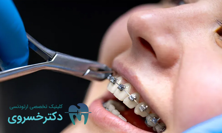 مزایای استفاده از تکنولوژی های نوین در درمان