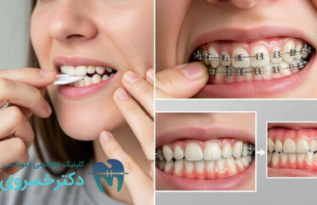 مهمترین تأثیر ارتودنسی بر سلامت عمومی بدن