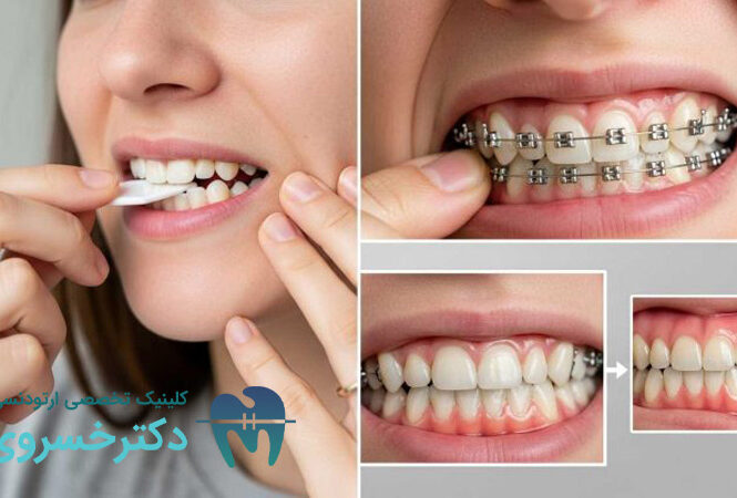 مهمترین تأثیر ارتودنسی بر سلامت عمومی بدن