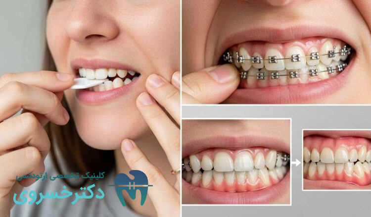 مهمترین تأثیر ارتودنسی بر سلامت عمومی بدن