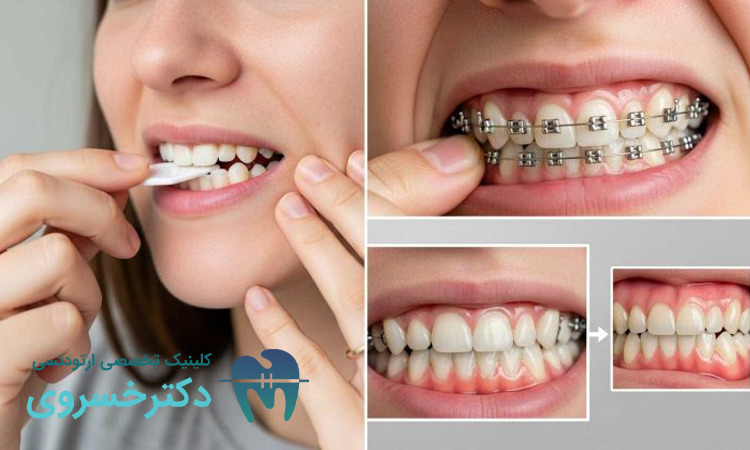 مهمترین تأثیر ارتودنسی بر سلامت عمومی بدن