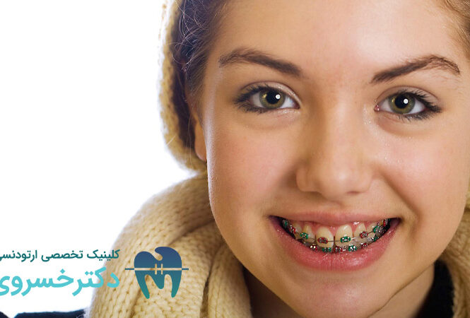 آیا ارتودنسی فقط برای زیبایی است؟