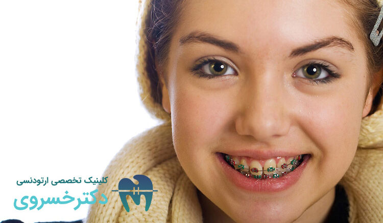 آیا ارتودنسی فقط برای زیبایی است؟