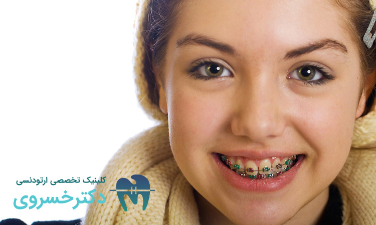 آیا ارتودنسی فقط برای زیبایی است؟