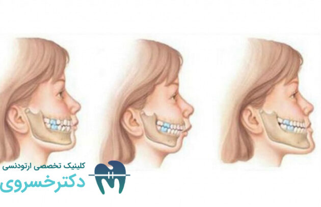 ارتباط ژنتیک و ناهنجاری های فکی
