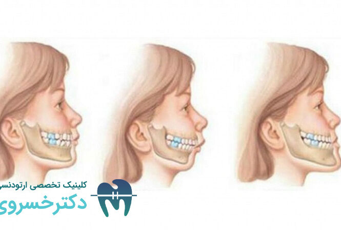 ارتباط ژنتیک و ناهنجاری های فکی