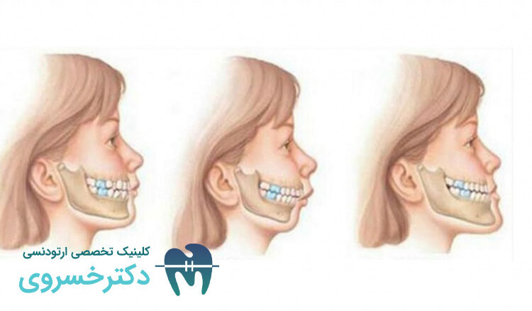 ارتباط ژنتیک و ناهنجاری های فکی