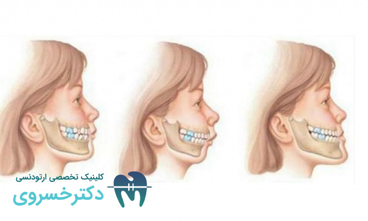 ارتباط ژنتیک و ناهنجاری های فکی