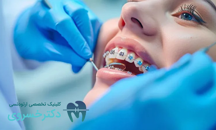 جدول عادات روزمره و تاثیر آن در درمان ارتودنسی